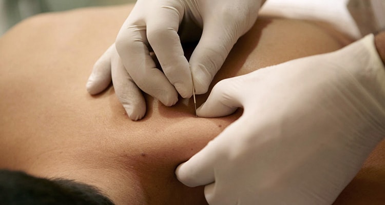 Physiotherapy Care at Home